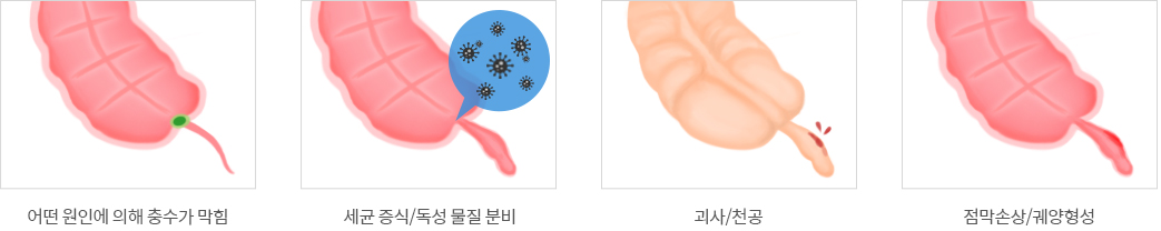 원인4가지